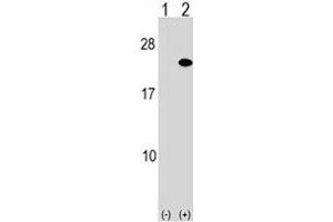 Western blot analysis of ARF5 antibody and 293 cell lysate either nontransfected (Lane 1) or transiently transfected (2) with the ARF5 gene. (ARF5 anticorps  (AA 80-108))