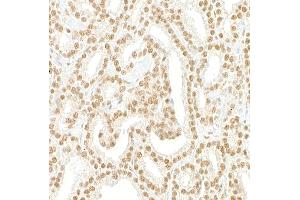 Immunohistochemistry (IHC) image for anti-PDS5, Regulator of Cohesion Maintenance, Homolog B (PDS5B) (AA 1200-1250) antibody (ABIN7455224)