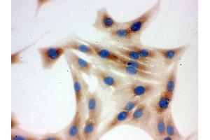 IHC analysis of TCP1 delta using anti-TCP1 delta antibody .