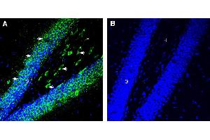 anti-Serotonin Receptor 6 (HTR6) (AA 167-181), (Extracellular) antibody