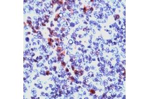 Image no. 1 for anti-Granzyme B (GZMB) (N-Term) antibody (ABIN372968) (GZMB anticorps  (N-Term))