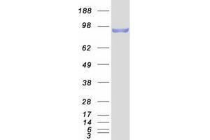 Validation with Western Blot