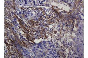 Immunohistochemistry (IHC) image for anti-Sterol O-Acyltransferase 2 (SOAT2) (AA 1-120) antibody (ABIN1490565)