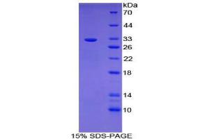 SDS-PAGE (SDS) image for B-Cell CLL/lymphoma 3 (BCL3) (AA 82-341) protein (His tag) (ABIN1879660)