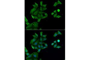 anti-Hyaluronan Binding Protein 2 (HABP2) (AA 24-313) antibody