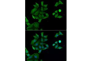 Immunofluorescence analysis of MCF7 cells using H antibody (ABIN6129030, ABIN6141583, ABIN6141584 and ABIN6222656). (HABP2 anticorps  (AA 24-313))