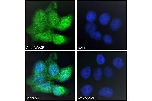 ABIN185368 Immunofluorescence analysis of paraformaldehyde fixed HepG2 cells, permeabilized with 0.