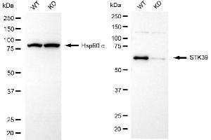 Western blotting analysis using STK39 antibody (ABIN7800304). (Recombinant STK39 anticorps)