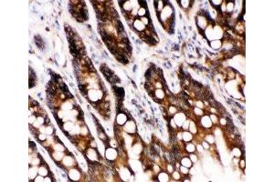 IHC-P: Caspase-6 antibody testing of rat intestine tissue