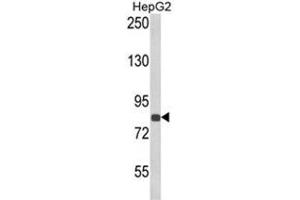 Western blot analysis of ECE1 Antibody (Center) in HepG2 cell line lysates (35ug/lane). (ECE1 anticorps  (Middle Region))