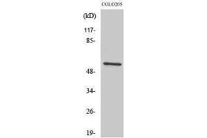 Western Blotting (WB) image for anti-IKAROS Family Zinc Finger 3 (Aiolos) (IKZF3) (Internal Region) antibody (ABIN3175609) (IKZF3 anticorps  (Internal Region))