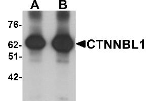 Western blot analysis of CTNNBL1 in human brain tissue lysate with CTNNBL1 antibody at (A) 1 and (B) 2 µg/mL. (CTNNBL1 anticorps  (C-Term))