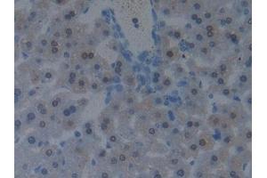 anti-Programmed Cell Death 6 Interacting Protein (PDCD6IP) (AA 1-239) antibody