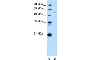 WB Suggested Anti-GAS7 Antibody Titration:  5. (GAS7 anticorps  (C-Term))