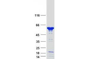 Validation with Western Blot