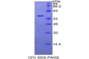 SDS-PAGE analysis of Human Periplakin Protein. (PPL Protéine)