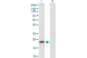 Western Blot analysis of KISS1 expression in transfected 293T cell line by KISS1 monoclonal antibody (M03), clone 1D11. (KISS1 anticorps  (AA 46-145))