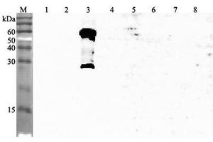 Western blot analysis using anti-ANGPTL3 (human), pAb  at 1:4'000 dilution.