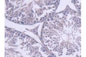 Detection of RNASEH2A in Mouse Testis Tissue using Polyclonal Antibody to Ribonuclease H2 Subunit A (RNASEH2A) (RNASEH2A anticorps  (AA 1-301))