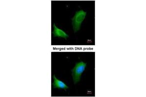 ICC/IF Image Immunofluorescence analysis of paraformaldehyde-fixed HeLa, using arginase I , antibody at 1:200 dilution.