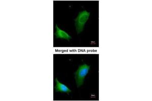ICC/IF Image Immunofluorescence analysis of paraformaldehyde-fixed HeLa, using arginase I , antibody at 1:200 dilution. (Liver Arginase anticorps)