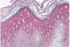 Human Skin: Formalin-Fixed, Paraffin-Embedded (FFPE)