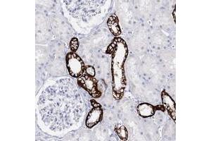 Immunohistochemical staining of human kidney with SLC17A2 polyclonal antibody  shows strong cytoplasmic and membranous positivity in cells in tubules at 1:50-1:200 dilution.