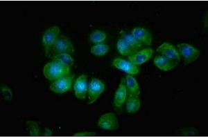 Immunofluorescence staining of HepG2 cells with ABIN7145515 at 1:66, counter-stained with DAPI.