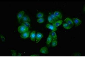 Immunofluorescence staining of HepG2 cells with ABIN7145515 at 1:66, counter-stained with DAPI. (Klotho beta anticorps  (AA 1-130))