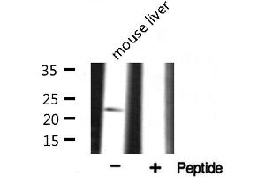 Western blot analysis on mouse liver lysate using RPS9 Antibody (RPS9 anticorps  (Internal Region))