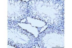 IHC analysis of MCM6 using anti-MCM6 antibody (ABIN7600037). (MCM6 anticorps  (AA 14-821))