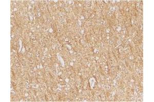 Image no. 1 for anti-anthrax Toxin Receptor 1 (ANTXR1) (Internal Region) antibody (ABIN205769)