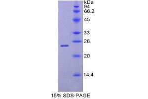 SDS-PAGE (SDS) image for Interferon, beta 1, Fibroblast (IFNB1) (AA 22-186) protein (His tag) (ABIN1980692)