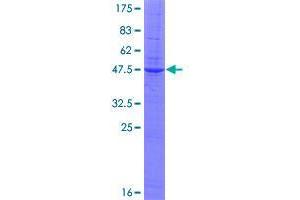 Image no. 1 for Gastrokine 2 (GKN2) (AA 1-184) protein (GST tag) (ABIN1355174)