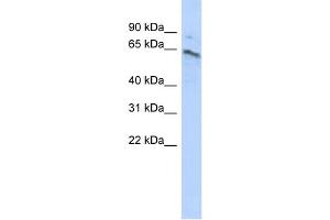 WB Suggested Anti-ZNF468 Antibody Titration:  0. (ZNF468 anticorps  (Middle Region))