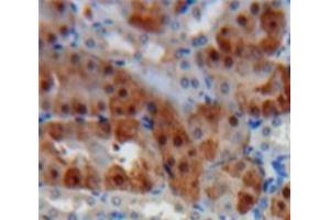 Used in DAB staining on fromalin fixed paraffin-embedded Kidney tissue (Cathepsin K anticorps  (AA 115-329))