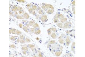 Immunohistochemistry of paraffin-embedded Human stomach using MSMB Polyclonal Antibody at dilution of 1:100 (40x lens). (MSMB anticorps)