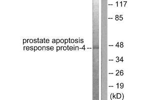 Western blot analysis of extracts from NIH/3T3 cells, using Prostate Apoptosis Response Protein-4 antibody (ABIN5976494). (PAWR anticorps  (C-Term))
