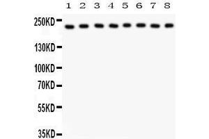 Anti- Integrin alpha 5 Picoband antibody, Western blotting All lanes: Anti Integrin alpha 5  at 0. (ITGA5 anticorps  (AA 787-992))