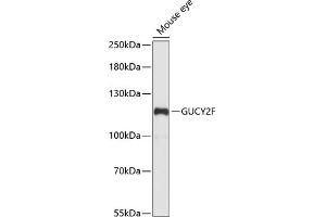 Western blot analysis of extracts of mouse eye, using GUCY2F antibody (ABIN7267553) at 1:1000 dilution. (GUCY2F anticorps  (AA 250-460))
