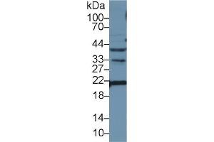 Detection of APOM in Mouse Liver lysate using Polyclonal Antibody to Apolipoprotein M (APOM)