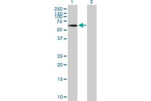 Western Blot analysis of TINAGL1 expression in transfected 293T cell line by TINAGL1 MaxPab polyclonal antibody. (TINAGL1 anticorps  (AA 1-467))