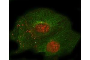IF analysis of Thrombomodulin/THBD using anti-Thrombomodulin/THBD antibody (ABIN7601141) and anti-Tubulin Alpha antibody (ABIN7600339).