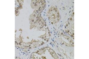 Immunohistochemistry of paraffin-embedded human prostate using MAPK1 antibody.