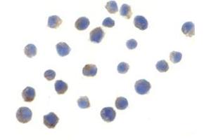 Immunocytochemistry of TLR6 in Jurkat cells with this product at 10 μg/ml.