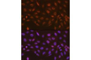anti-RAD23 Homolog A (RAD23A) antibody