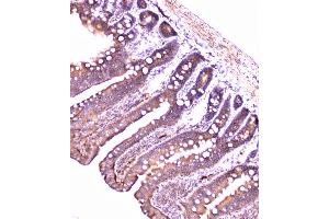 IHC analysis of PON1 using anti-PON1 antibody (ABIN6719356).