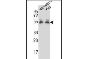 PRCP Antibody (N-term) (ABIN657308 and ABIN2846386) western blot analysis in MDA-M,Hela cell line lysates (35 μg/lane). (PRCP anticorps  (N-Term))