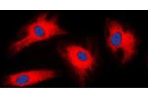 Immunofluorescent analysis of 14-3-3 zeta staining in HeLa cells. (14-3-3 zeta anticorps  (Center))