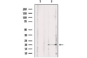 Western blot analysis of extracts from rat brain, using MPV17 antibody.